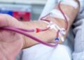 Diyaliz nedir? Prof. Dr. Bilal Görçin anlatıyor