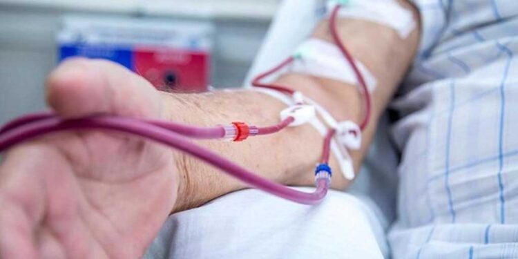 Diyaliz nedir? Prof. Dr. Bilal Görçin anlatıyor
