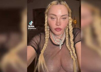 ABD’li şarkıcı Madonna sosyal medya hesabından estetikli halini paylaştı.
