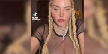 ABD’li şarkıcı Madonna sosyal medya hesabından estetikli halini paylaştı.