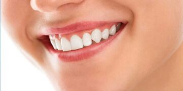 Diş dolgusu yaptırmaya korkuyor musunuz? Dr. Berkan Yıldız, diş dolgusunu anlatıyor