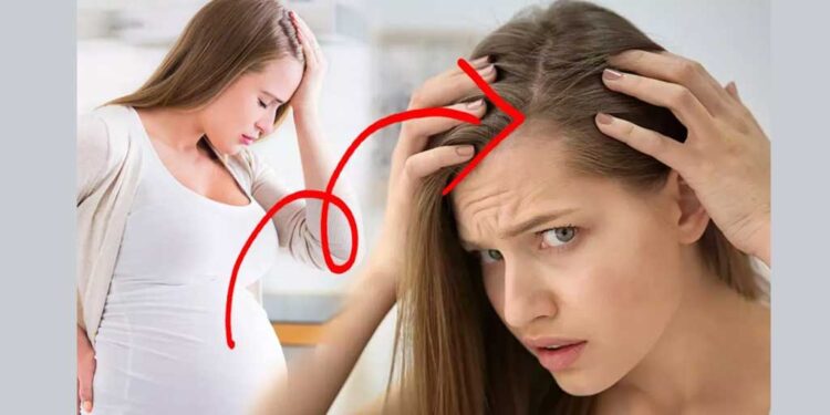 Anne adaylarının korkulu rüyası saç dökülmesi! Dermatolog Deniz Yardımcı sizler için anlattı