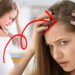 Anne adaylarının korkulu rüyası saç dökülmesi! Dermatolog Deniz Yardımcı sizler için anlattı