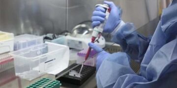 Karaciğer hemanjiyomları nasıl tedavi edilir? Prof. Dr. Adem Uçar anlatıyor