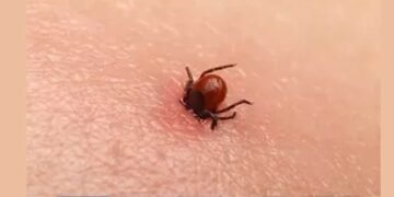 Sıcaklar geliyor tehlike baş gösterdi! Kene uygun şekilde çıkarılmazsa ölümcül olabilir