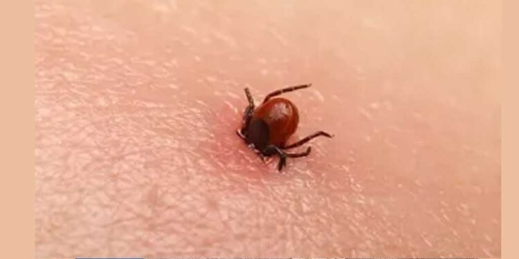 Sıcaklar geliyor tehlike baş gösterdi! Kene uygun şekilde çıkarılmazsa ölümcül olabilir