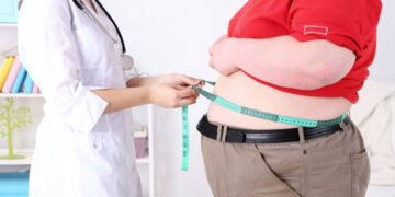 Obezite cerrahisi nedir? Kimlere uygulanır?